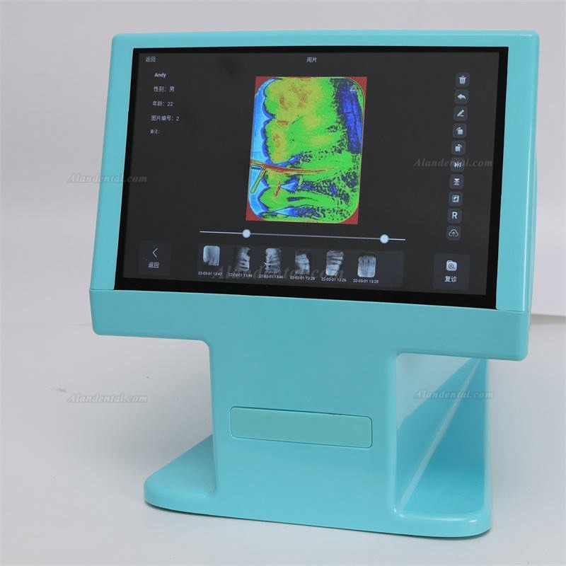 Dynamic DDT-100A Dental Digital Phosphor Plate Scanner PSP X ray Scanner